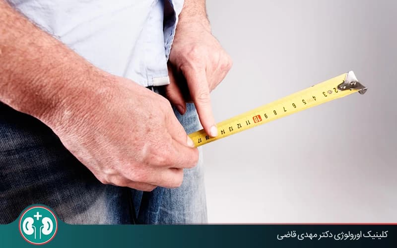 مراجعة علمية لتمارين الجلكينغ لزيادة حجم القضيب: الأضرار والبدائل