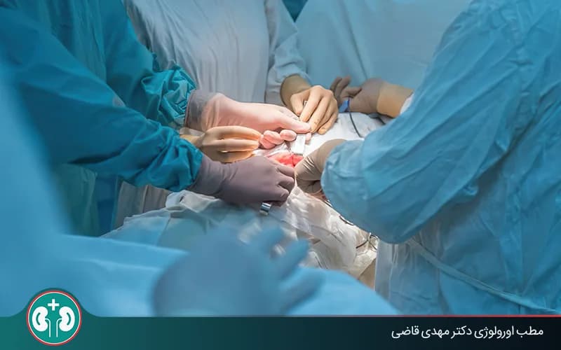 جراحی باز سنگ کلیه؛ درمان قطعی برای سنگ‌های بزرگ