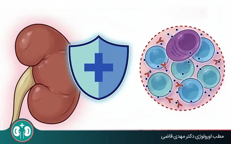 علائم پس زدن پیوند کلیه و نشانه‌های هشدار آن را بدانید