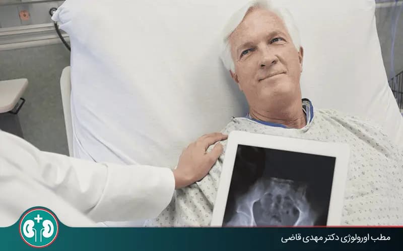 طول عمر بیماران سرطان مثانه چقدر است؟ نقش عوامل فردی و پزشکی