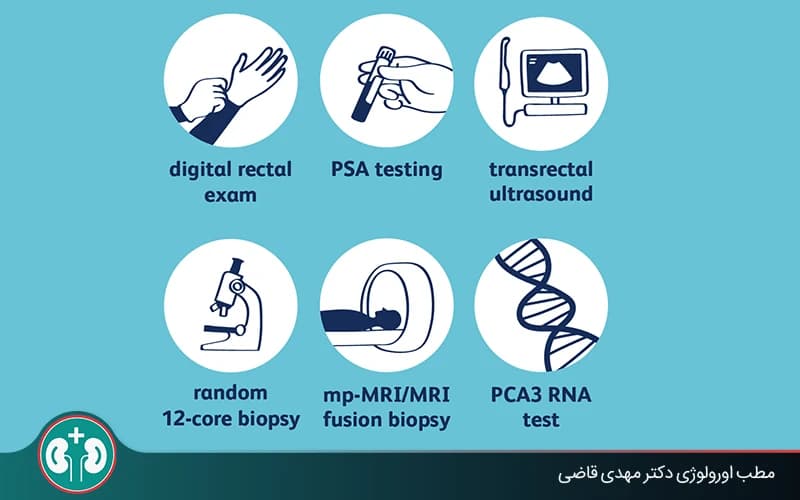 تشخيص سرطان البروستاتا: من اختبار PSA إلى الخزعة