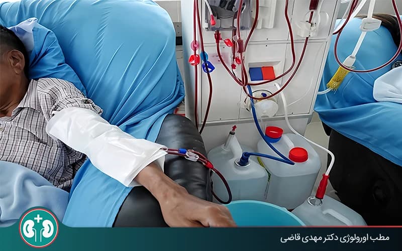 ما هو غسيل الكلى وكيف يُجرى؟