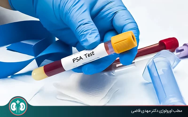 تفسير PSA بعد جراحة البروستاتا: هل يعني ارتفاعه وجود سرطان؟