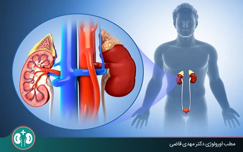 What Is Pyelonephritis? Kidney Infection Symptoms, Diagnosis, and Treatment