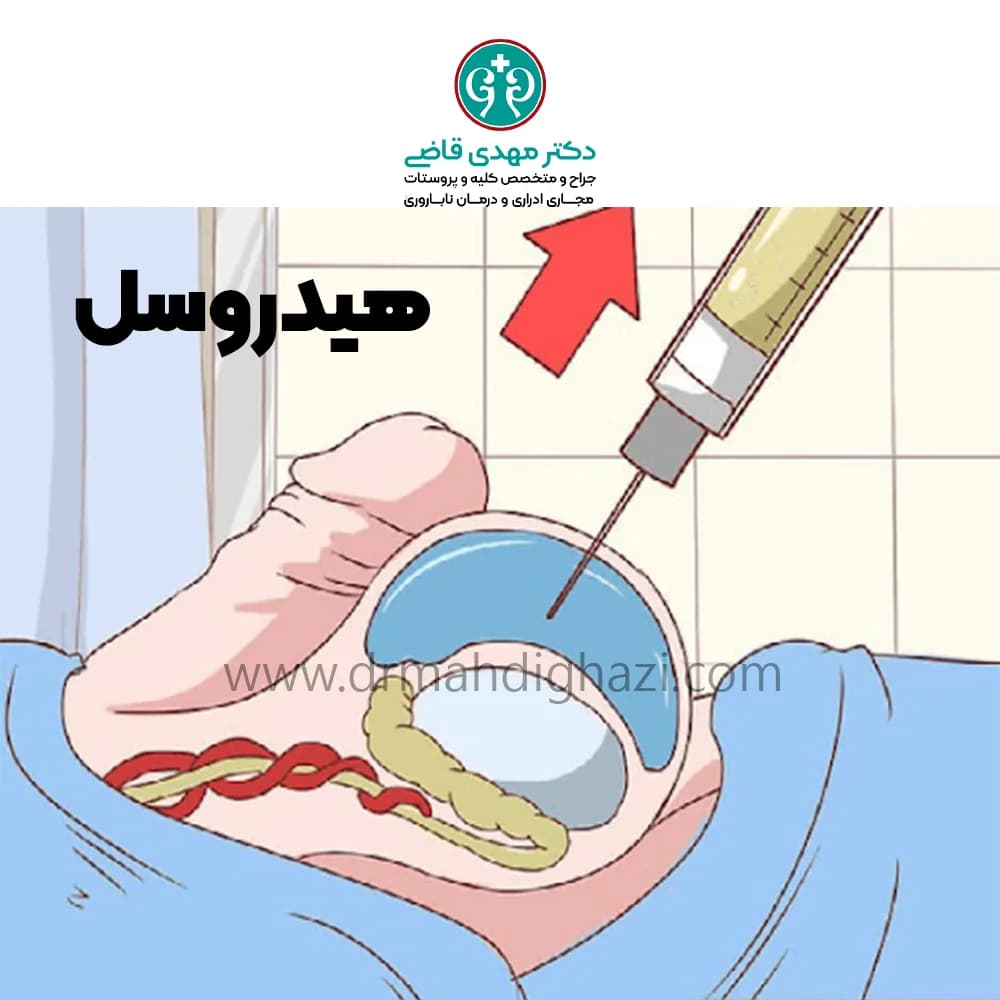 دکتر قاضی-هیدروسل چیست