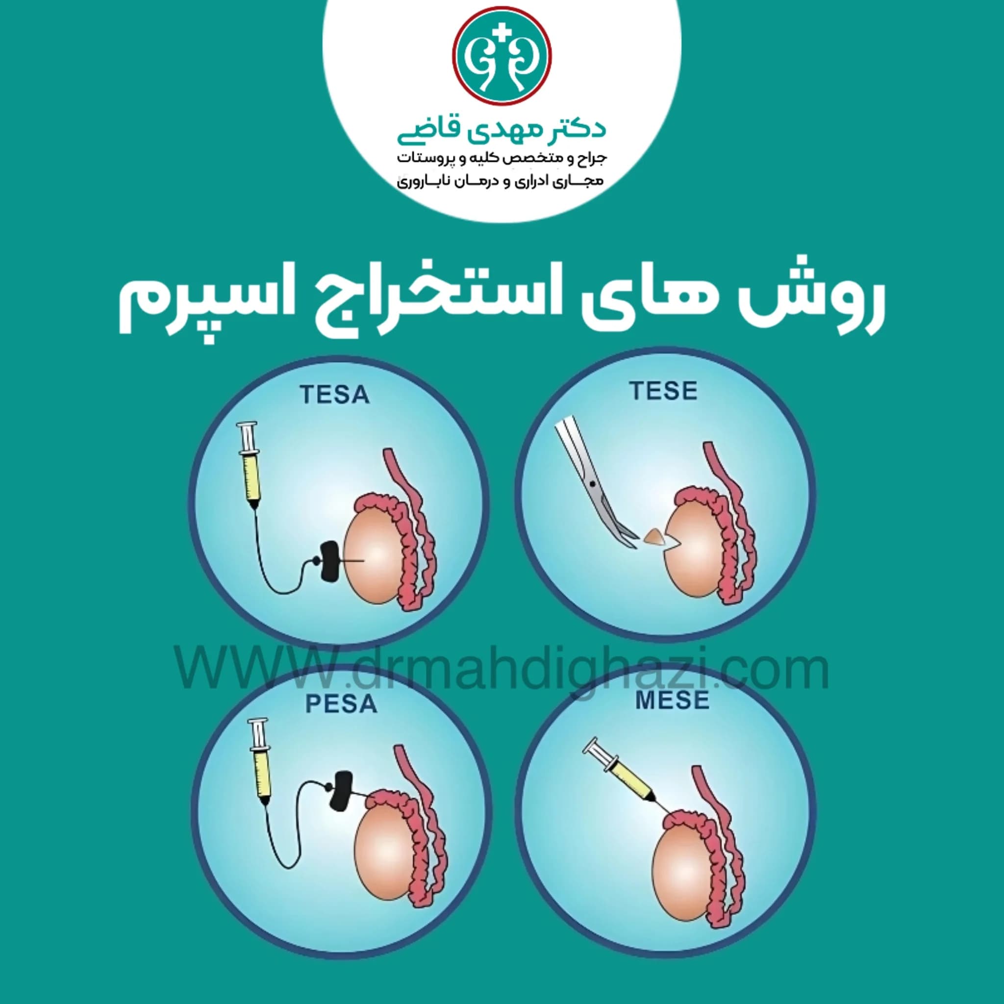 دکتر قاضی-روش های استخراج اسپرم