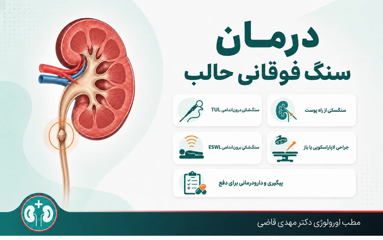 درمان سنگ حالب فوقانی (دفع طبیعی، TUL، ESWL مینی PCNL)