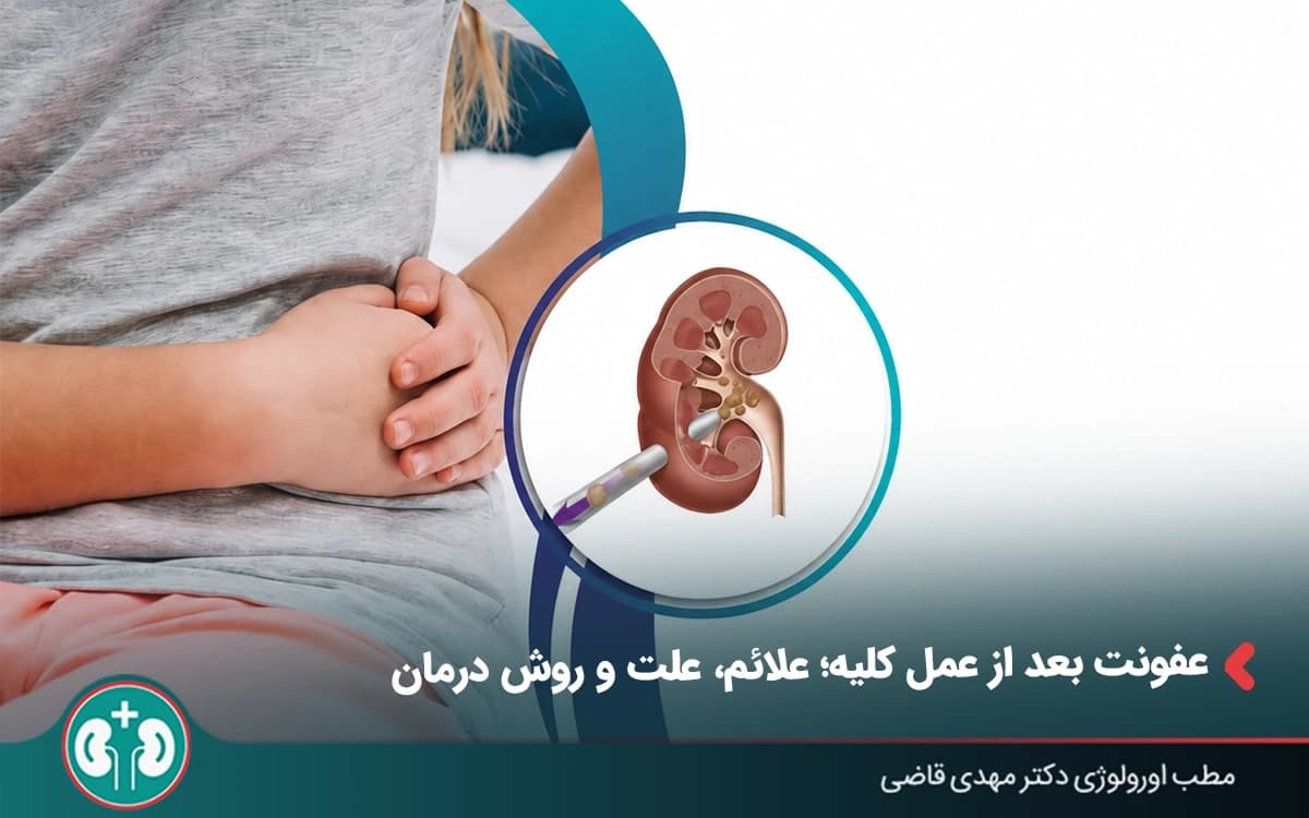 عفونت بعد از عمل کلیه؛ علائم، علت و روش درمان