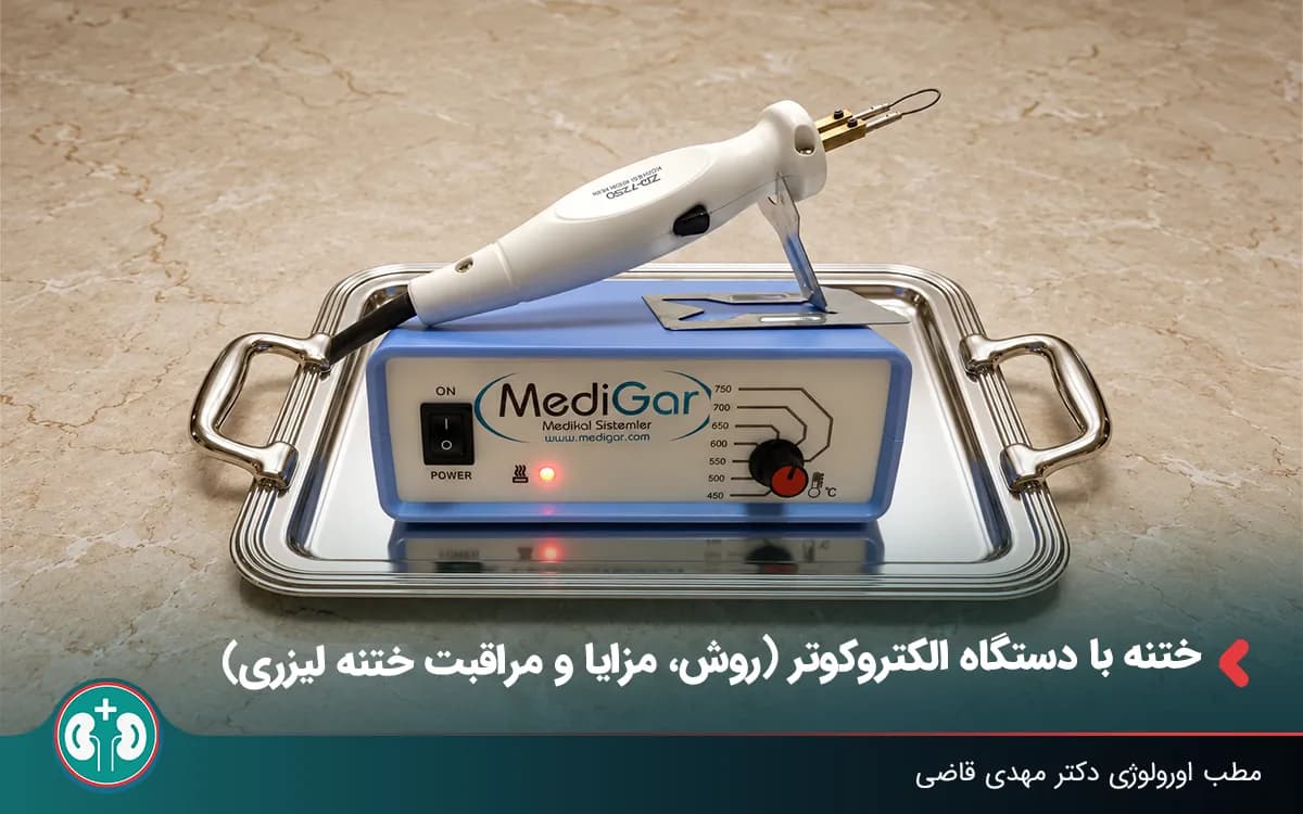 ختنه با دستگاه الکتروکوتر (روش، مزایا و مراقبت ختنه لیزری)
