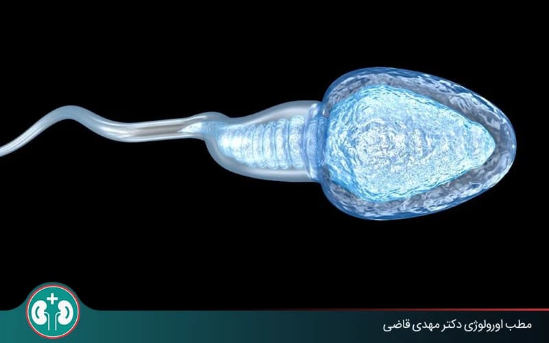 اسپرم بعد از وازکتومی چه میشود؟