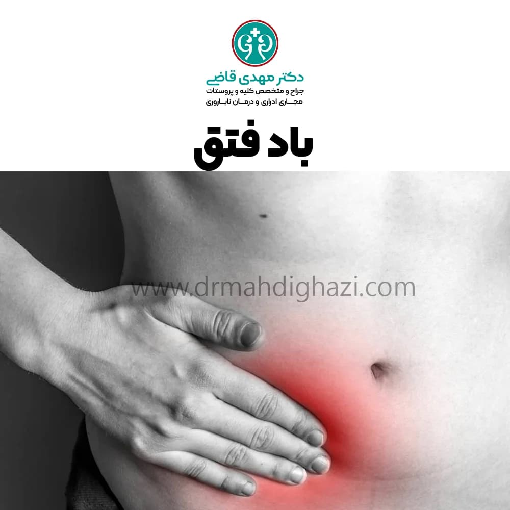 دکتر قاضی - باد فتق علل و درمان