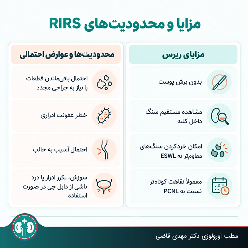 مزایا و محدودیت‌های RIRS (ریرس) برای درمان سنگ لگنچه کلیه