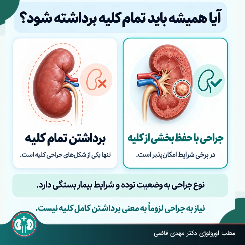 امکان حفظ کلیه بعد از جراحی تومور خوش‌خیم کلیه