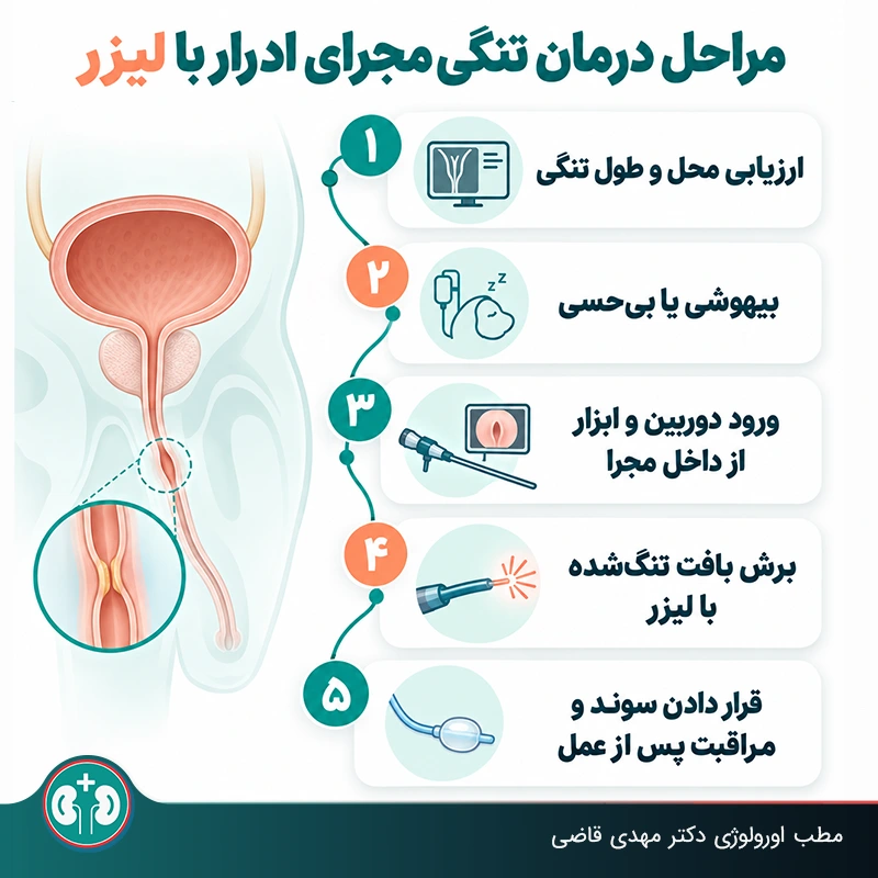 مراحل جراحی درمان تنگی مجرای ادرار با لیزر