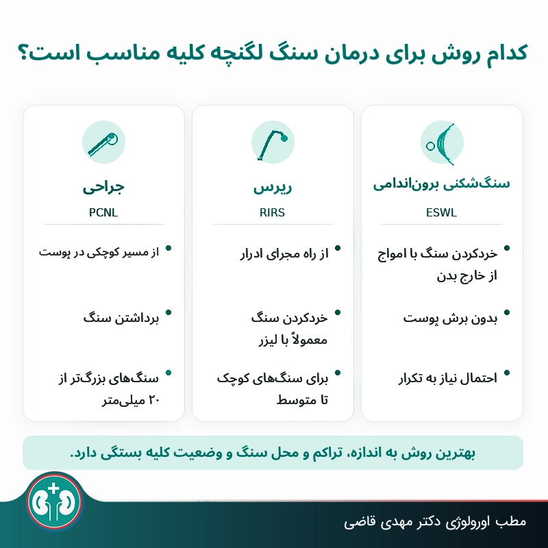 روش‌های درمان سنگ لگنچه کلیه: RIRS، ESWL،‌ PCNL