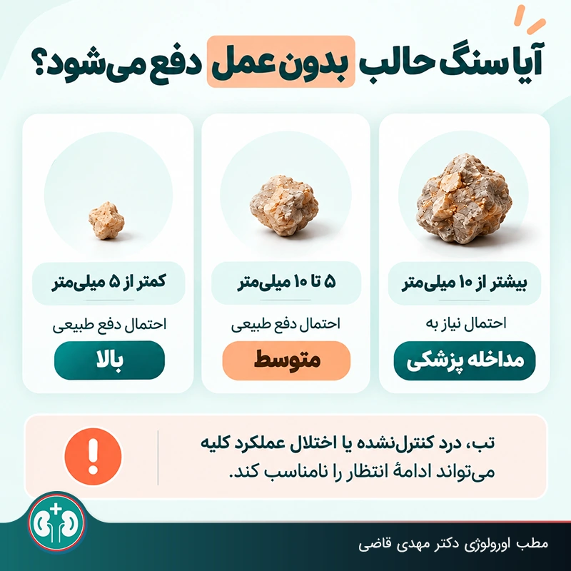 احتمال دفع طبیعی سنگ حالب آیا سنگ ۵ میلی متری دفع می‌شود؟