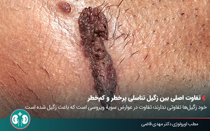 علائم زگیل تناسلی بدخیم + روشهای تشخیص و درمان