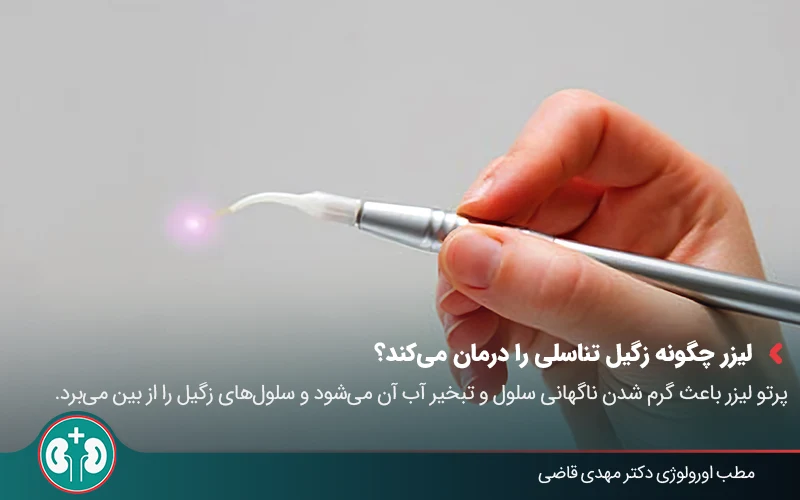 درمان زگیل تناسلی با لیزر | مقایسه با سایر روشها