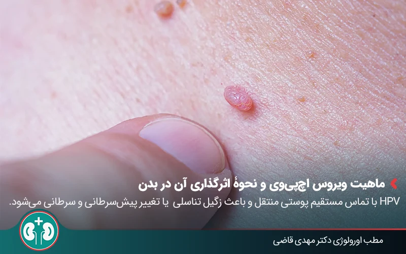 ویروس HPV چیست؟ روشهای انتقال، پیشگیری و درمان