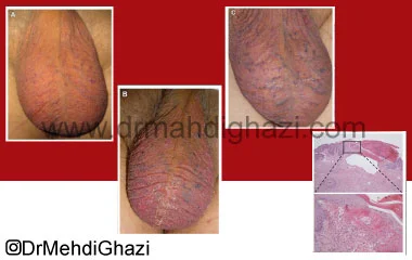 ضایعات پوستی