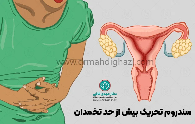 دکتر قاضی- بهترین روشهای درمان ناباروری
