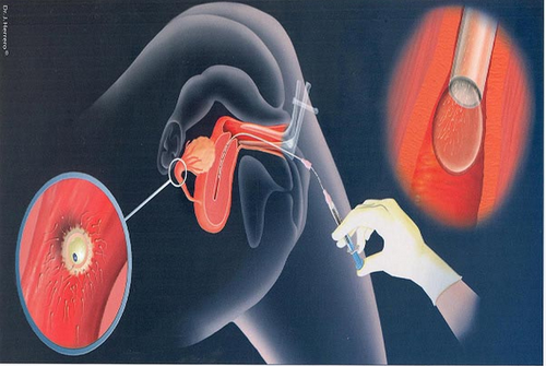 IUI - Dr. Mahdi Ghazi website