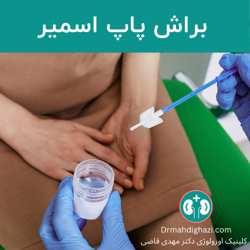فرشاة لأخذ العينات للتحقق من التغيرات في خلايا الأنسجة في اختبار مسحة عنق الرحم