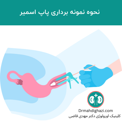 كيفية أخذ عينات من الآفات المشبوهة داخل المهبل لإجراء مسحة عنق الرحم