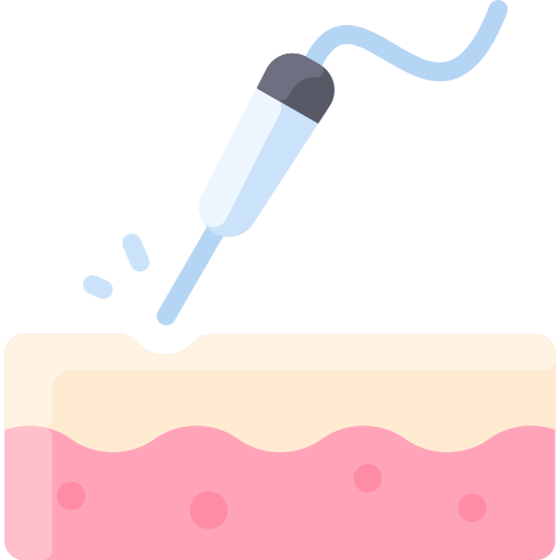 Men's laser hair removal