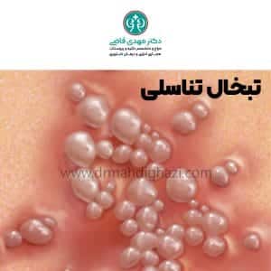 دکتر مهدی قاضی- تبخال تناسلی