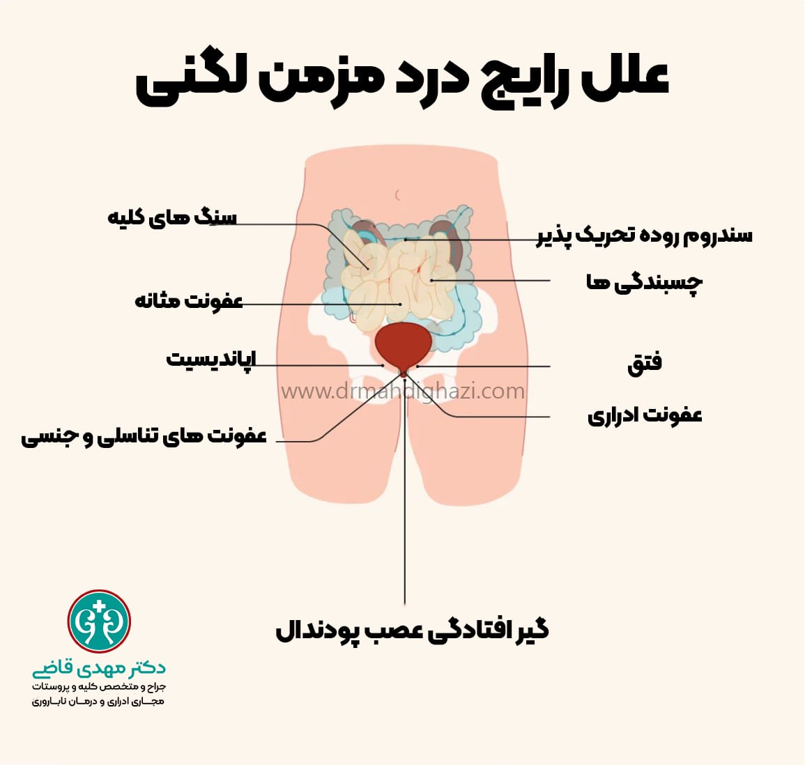 دکتر مهدی قاضی- علل درد مزمن لگنی