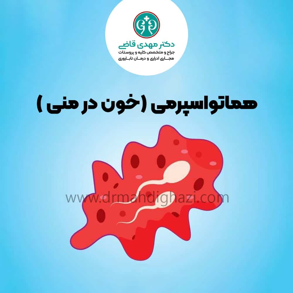 دکتر مهدی قاضی-• هماتواسپرمی چیست