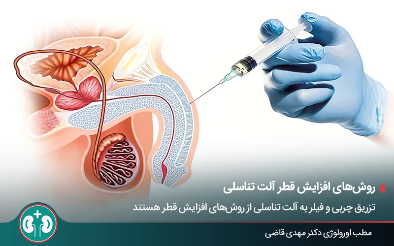 تزریق چربی و فیلر به آلت برای افزایش قطر آن