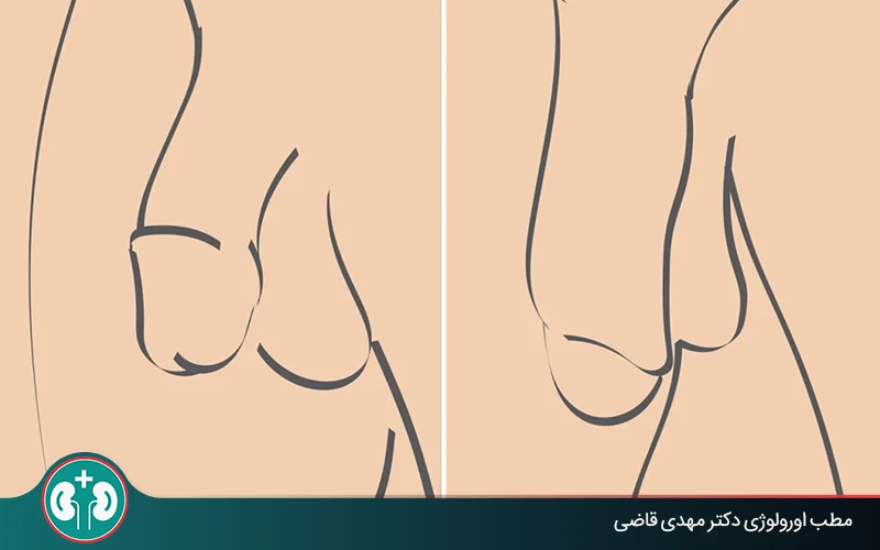 همه چیز درباره روش‌های بزرگ کردن آلت تناسلی؛ روش‌های علمی و غیرعلمی