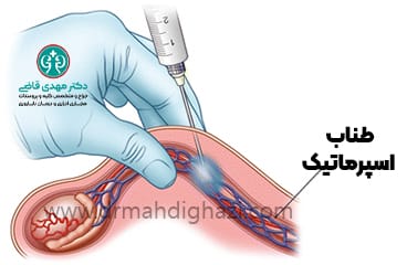 دکتر مهدی قاضی- درد بیضه