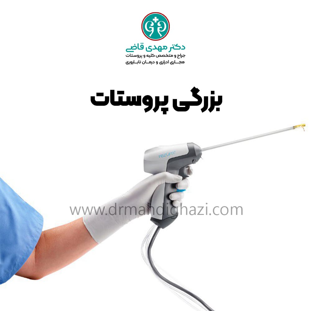 دکتر مهدی قاضی-هایپرپلازی خوش خیم پروستات BPH