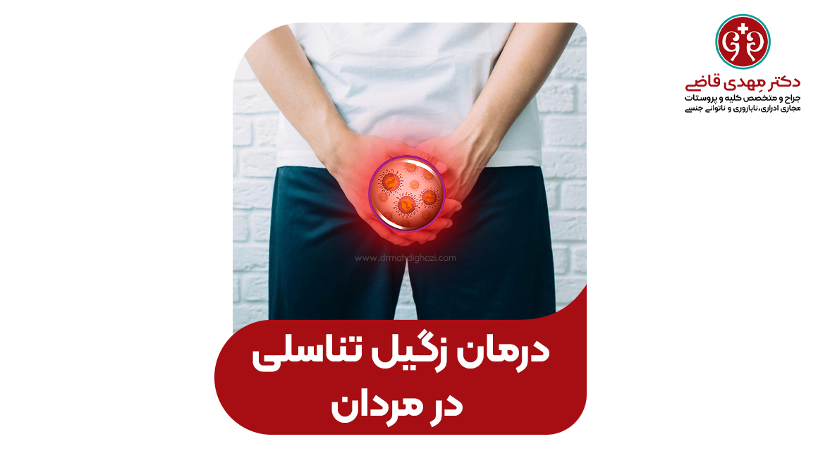 درمان زگیل تناسلی در مردان مشهد