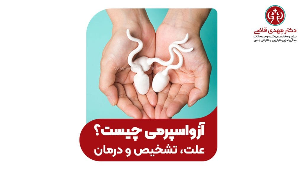 آزواسپرمی