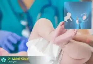 نهان بیضگی یا بیضه نزول نکرده