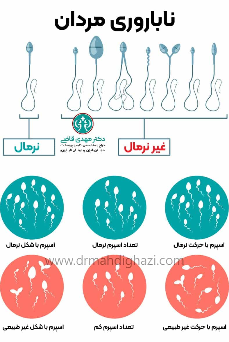 دکتر مهدی قاضی -تزریق اسپرم به داخل سیتوپلاسم روش‌های تشخیص ناباروری مردان تأثیر سبک زندگی بر ناباروری مردان درمان‌های هورمونی برای ناباروری مردان جراحی‌های رفع انسداد اسپرم تأثیر مکمل‌ها بر کیفیت اسپرم درمان‌های پیشرفته ناباروری مردان مشاوره ژنتیک برای ناباروری مردان