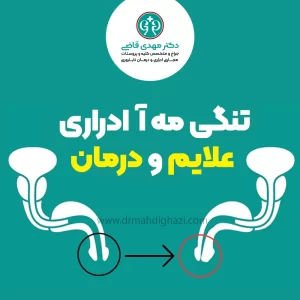 تنگی مه آ ادراری
