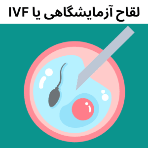 لقاح آزمایشگاهی یا IVF 1