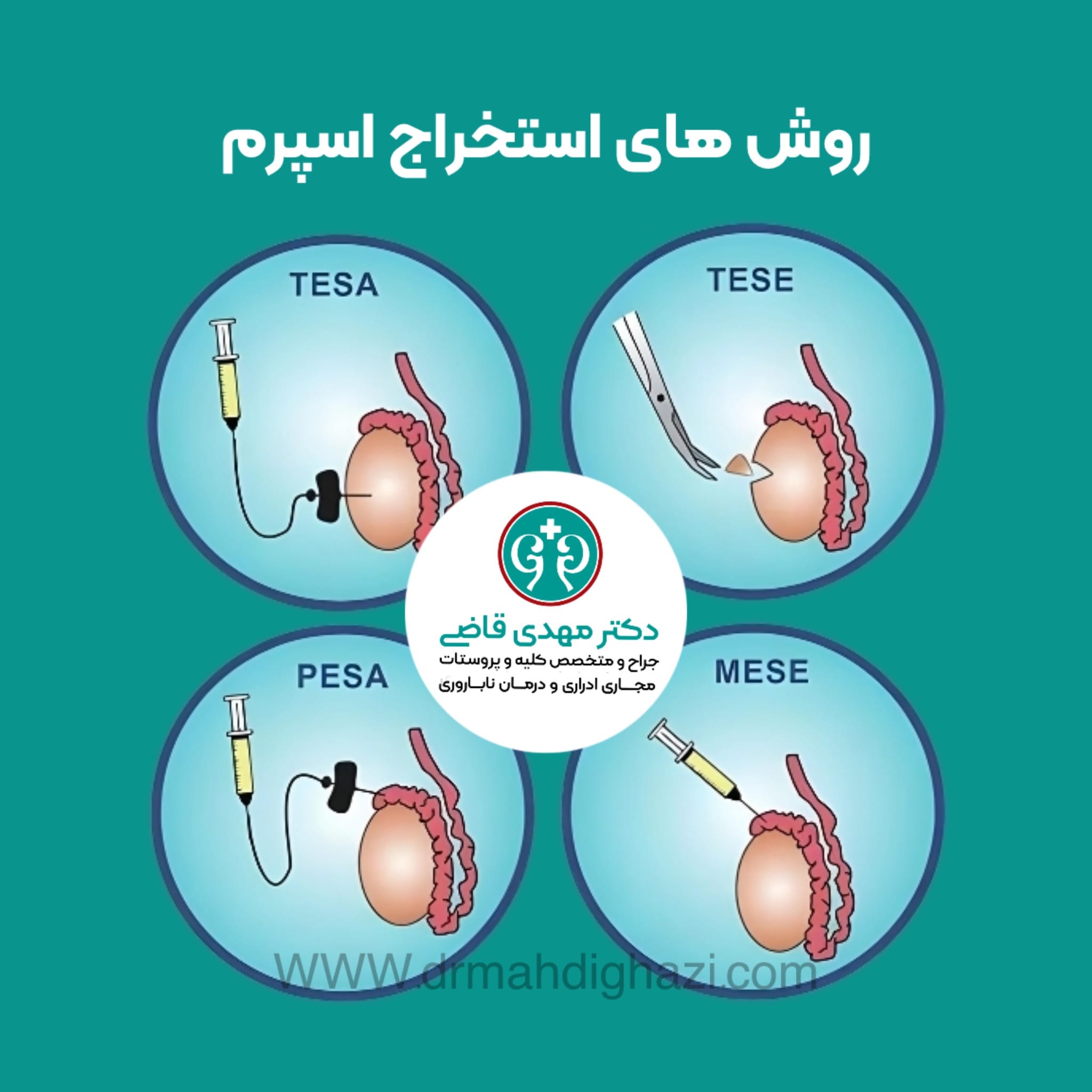 چه چیزی باعث عقیم شدن مرد میشود؟