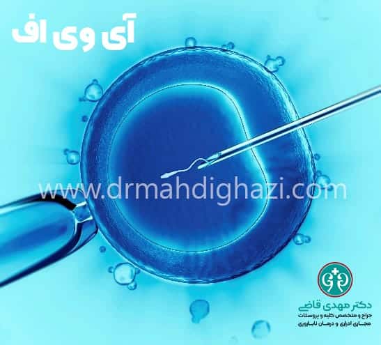 دکتر مهدی قاضی-• IVF • لقاح مصنوعی • تکنیک‌های IVF • مراحل IVF • عوارض جانبی IVF • هزینه IVF در ایران • بهترین کلینیک‌های IVF • موفقیت IVF در اولین بار • بهترین روش‌های درمان ناباروری