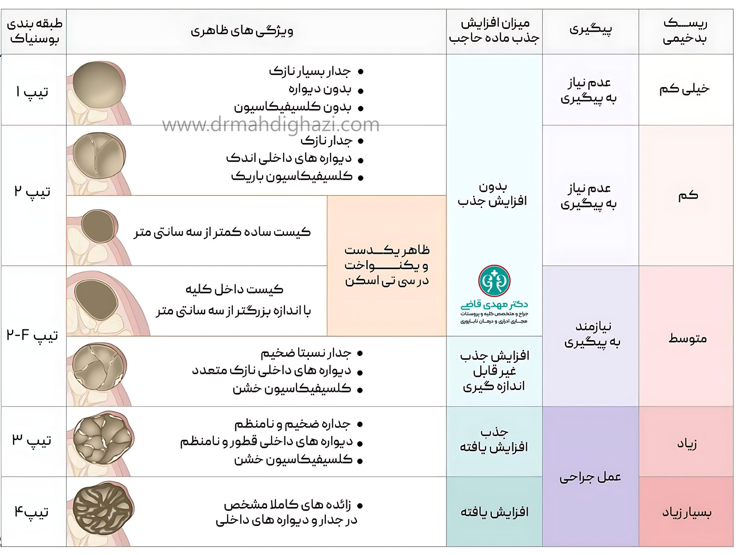 دکتر مهدی قاضی-کیست کلیه کیست‌های کلیوی کلیه پلی کیستیک کیست ساده کلیه علائم کیست کلیه درمان کیست کلیه علت ایجاد کیست کلیه در بزرگسالان درمان درد کیست کلیه علائم کیست عفونی کلیه آیا کیست‌های کلیه می‌توانند سرطانی شوند دوره بهبودی پس از جراحی برداشتن کیست کلیه درمان خانگی کیست کلیه کیست‌های کلیوی در بزرگسالان علائم عفونت کیست کلیه دوره بهبودی پس از جراحی کیست کلیه آیا کیست‌های کلیه می‌توانند سرطانی شوند؟ 