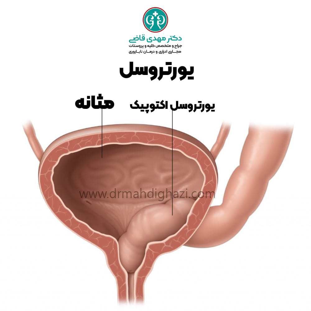 دکتر مهدی قاضی-یورتروسل