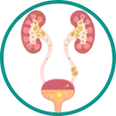 تصویر سنک کلیه و سیستم ادراری جهت درمان سنگ کلیه