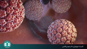 مقایسه روش‌های درمان زگیل تناسلی؛ بهترین روش درمان کدام است؟