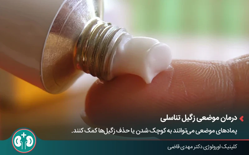 استفاده از داروهای موضعی برای درمان زگیل تناسلی