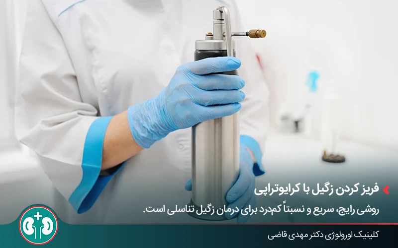 کرایوتراپی؛ یکی از روش‌های درمان زگیل تناسلی